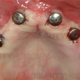 dental treatment HUngary