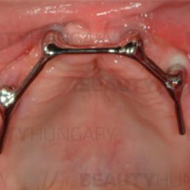 dental treatment Hungary